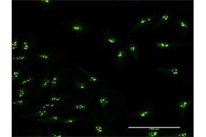 Immunofluorescence of purified MaxPab antibody to KIAA0020 on HeLa cell. (KIAA0020 anticorps  (AA 1-648))