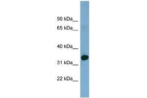 WB Suggested Anti-HOXD12 Antibody Titration: 0. (HOXD12 anticorps  (Middle Region))