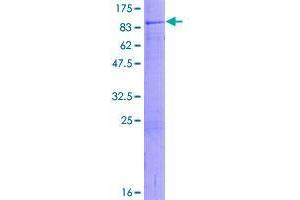 Image no. 1 for Zinc Finger, HIT-Type Containing 6 (ZNHIT6) (AA 1-470) protein (GST tag) (ABIN1326485)