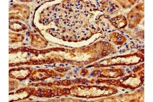 Immunohistochemistry of paraffin-embedded human kidney tissue using ABIN7153175 at dilution of 1:100 (FZD1 anticorps  (AA 73-322))