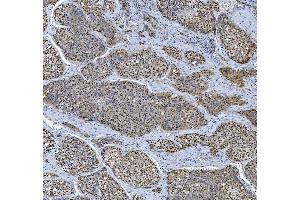 IHC analysis of TRMT6 using anti-TRMT6 antibody (ABIN7602138). (TRMT6 anticorps  (AA 6-489))