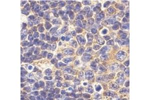 Immunohistochemistry of TLR1 in mouse spleen tissue with this product at 10 μg/ml. (TLR1 anticorps  (N-Term))