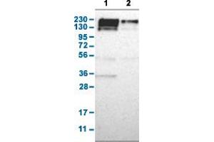 Western Blot analysis with PARP4 polyclonal antibody . (PARP4 anticorps  (AA 247-392))