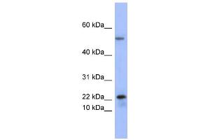 WB Suggested Anti-PLA2G5 Antibody Titration:  0. (PLA2G5 anticorps  (Middle Region))