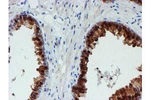 Image no. 2 for anti-Phosphoglucomutase 3 (PGM3) antibody (ABIN1500178) (Phosphoglucomutase 3 anticorps)