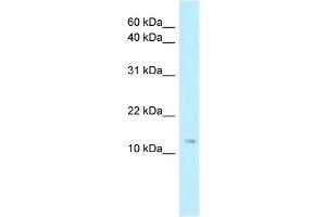 WB Suggested Anti-Stmn1 Antibody Titration: 1. (Stathmin 1 anticorps  (N-Term))