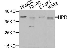Western blot analysis of extracts of various cells, using HPR antibody. (HPR anticorps)