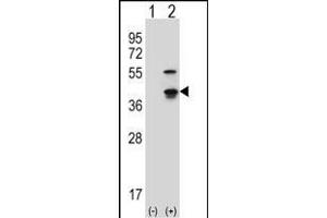 Western blot analysis of Cdk3 (arrow) using rabbit polyclonal Mouse Cdk3 Antibody (C-term) (ABIN657724 and ABIN2846710). (CDK3 anticorps  (C-Term))