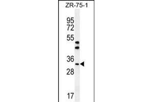 AREG Antibody (C-term) (ABIN392202 and ABIN2841903) western blot analysis in ZR-75-1 cell line lysates (35 μg/lane). (Amphiregulin anticorps  (C-Term))