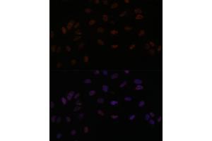 Immunofluorescence analysis of U-2 OS cells using PPP4R3B antibody (ABIN7270374) at dilution of 1:100.