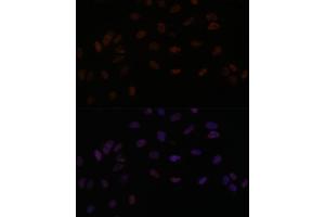 Immunofluorescence analysis of U-2 OS cells using PPP4R3B antibody (ABIN7270374) at dilution of 1:100. (SMEK2 anticorps  (AA 628-817))