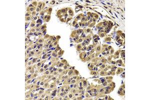 Immunohistochemistry of paraffin-embedded Rat stomach using CCT2 antibody at dilution of 1:100 (x400 lens). (CCT2 anticorps)