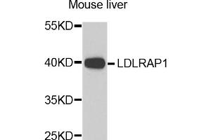 Western blot analysis of extracts of mouse liver, using LDLRAP1 antibody (ABIN5974266) at 1/1000 dilution. (LDLRAP1 anticorps)
