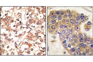 Image no. 2 for anti-BCL2 Binding Component 3 (BBC3) (BH3 Domain), (C-Term) antibody (ABIN356830)