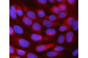 IF analysis of SRPRB using anti-SRPRB antibody (ABIN7602015).