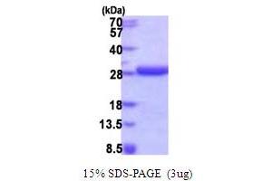 SDS-PAGE (SDS) image for HD Domain Containing 2 (HDDC2) (AA 1-204) protein (His tag) (ABIN5853988)