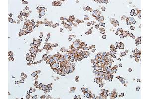 Immunocytochemistry (ICC) image for anti-Cadherin 1, Type 1, E-Cadherin (Epithelial) (CDH1) (AA 155-707) antibody (ABIN7454024)