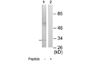 Image no. 1 for anti-MAX-Like Protein X (MLX) antibody (ABIN272258) (MLX anticorps)