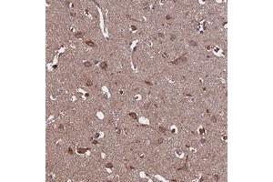 Immunohistochemical staining of human cerebral cortex with KCNG1 polyclonal antibody  shows moderate cytoplasmic positivity in neuronal cells at 1:200-1:500 dilution.
