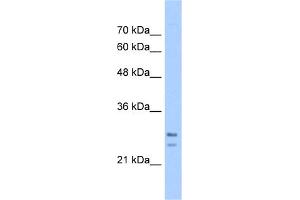 WB Suggested Anti-SRPRB Antibody Titration:  5. (SRPRB anticorps  (C-Term))