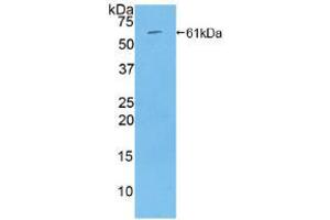 Western blot analysis of recombinant Rat THBS4. (THBS4 anticorps  (AA 708-963))