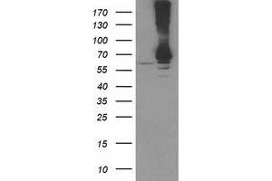 Western Blotting (WB) image for anti-Ribophorin 1 (RPN1) antibody (ABIN1500753)