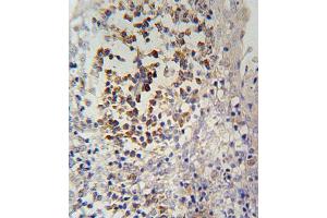 IL12RB2 Antibody (C-term) (ABIN654644 and ABIN2844340) immunohistochemistry analysis in formalin fixed and paraffin embedded human tonsils tissue followed by peroxidase conjugation of the secondary antibody and DAB staining. (IL12_2 (AA 756-783), (C-Term) anticorps)