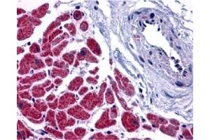 Immunohistochemistry (IHC) image for anti-Caspase 12 (Gene/pseudogene) (CASP12) (N-Term) antibody (ABIN1031295) (Caspase 12 anticorps  (N-Term))