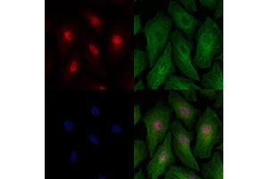 Phospho-IRF7 (Ser439) Antibody staining A549 cells(heat shock treatment) by IF/ICC.