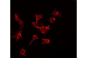 ABIN6272668 staining Hela by IF/ICC. (BCMA anticorps  (Internal Region))