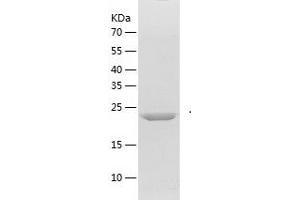 Western Blotting (WB) image for Fibroblast Growth Factor 20 (FGF20) (AA 3-211) protein (His tag) (ABIN7122932) (FGF20 Protein (AA 3-211) (His tag))