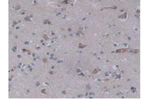 IHC-P analysis of Human Brain Tissue, with DAB staining. (JAG2 anticorps  (AA 714-981))