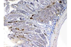 IHC analysis of Factor D using anti-Factor D antibody . (Adipsin anticorps  (AA 26-263))