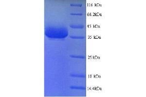 SDS-PAGE (SDS) image for Y Box Binding Protein 1 (YBX1) (AA 2-322) protein (His tag) (ABIN5713952)