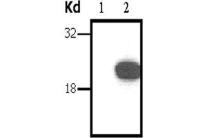 Image no. 1 for anti-DIRAS Family, GTP-Binding RAS-Like 3 (DIRAS3) antibody (ABIN790752) (DIRAS3 anticorps)