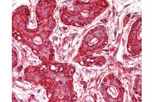Anti-ACTG1 / Gamma Actin antibody IHC staining of human breast.