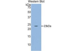 Western Blotting (WB) image for anti-CD8b Molecule (CD8B) (AA 21-208) antibody (ABIN1858317) (CD8B anticorps  (AA 21-208))