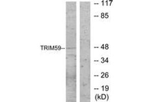 Western blot analysis of extracts from NIH-3T3 cells, using TRIM59 Antibody. (TRIM59 anticorps  (AA 191-240))