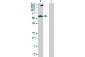 Western Blot analysis of NUP62 expression in transfected 293T cell line by NUP62 MaxPab polyclonal antibody. (NUP62 anticorps  (AA 1-522))