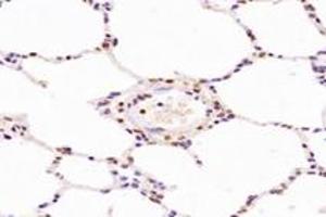 Immunohistochemistry analysis of paraffin-embedded rat lung using,NCAPG2 (ABIN7074856) at dilution of 1: 1600 (NCAPG2 anticorps)