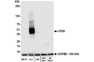 Western Blotting (WB) image for anti-CD28 (CD28) (AA 170-220) antibody (ABIN7455122) (Recombinant CD28 anticorps  (AA 170-220))
