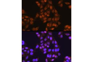 Immunofluorescence analysis of HeLa cells using UB Rabbit pAb (2359) at dilution of 1:100 (40x lens). (UBA1 anticorps  (AA 300-600))