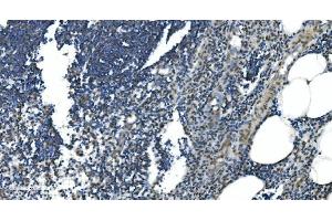IHC analysis of LSM7 using anti-LSM7 antibody (ABIN7598937). (LSM7 anticorps  (AA 1-103))