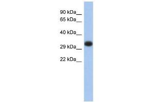 HLA-DPA1 antibody used at 1 ug/ml to detect target protein. (HLA-DPA1 anticorps  (Middle Region))