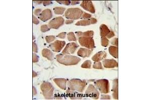 Formalin-fixed and paraffin-embedded human skeletal muscle reacted with RUVBL1 Antibody, which was peroxidase-conjugated to the secondary antibody, followed by DAB staining.