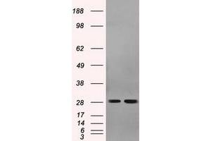 Image no. 2 for anti-Replication Protein A2, 32kDa (RPA2) antibody (ABIN1500733) (RPA2 anticorps)