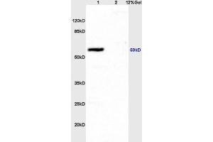 Lane 1: rat brain lysates Lane 2: rat heart lysates probed with Anti CD54/ICAM-1 Polyclonal Antibody, Unconjugated (ABIN670806) at 1:200 in 4 °C.