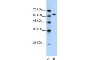 Western Blotting (WB) image for anti-FACT complex subunit SPT16 (SUPT16H) antibody (ABIN2460242) (SUPT16H anticorps)