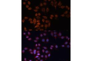 Immunofluorescence analysis of HeLa cells using  Polyclonal Antibody (ABIN6131157, ABIN6136523, ABIN6136524 and ABIN6223703) at dilution of 1:100 (40x lens). (ADAM15 anticorps)