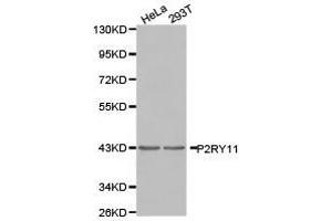 Western Blotting (WB) image for anti-Purinergic Receptor P2Y, G-Protein Coupled, 11 (P2RY11) antibody (ABIN1874013) (P2RY11 anticorps)